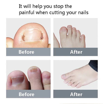 Nail Clipper